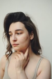 Acne and pimples